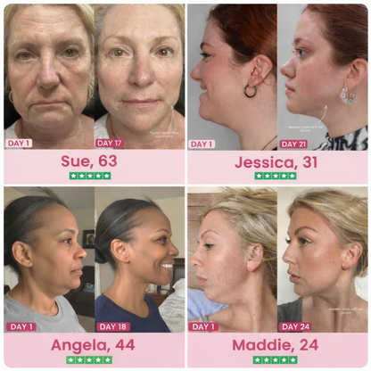 JawGlow Collagen Chin Lifting Gel Mask